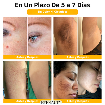 1+1 GRATIS - BEEGONE™ | ELIMINA LAS VERRUGAS Y MARCAS DE ACNE EN 7 DIAS DE FORMA 100% NATURAL