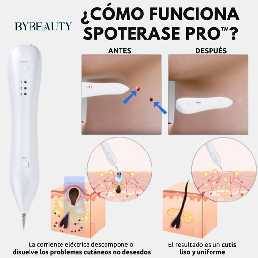 1+1 GRATIS - SPOTERASE PRO™ l ELIMINA VERRUGAS Y PEQUEÑOS TATUAJES EN SEGUNDOS