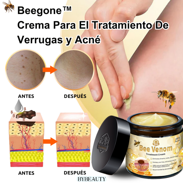 1+1 GRATIS - BEEGONE™ | ELIMINA LAS VERRUGAS Y MARCAS DE ACNE EN 7 DIAS DE FORMA 100% NATURAL