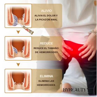 1+1 GRATIS - HEMORRHOID NATURAL OINTMENT™ | ALIVIO INSTANTÁNEO Y NATURAL PARA HEMORROIDES