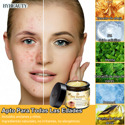 1+1 GRATIS - BEEGONE™ | ELIMINA LAS VERRUGAS Y MARCAS DE ACNE EN 7 DIAS DE FORMA 100% NATURAL