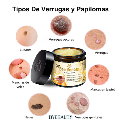 1+1 GRATIS - BEEGONE™ | ELIMINA LAS VERRUGAS Y MARCAS DE ACNE EN 7 DIAS DE FORMA 100% NATURAL