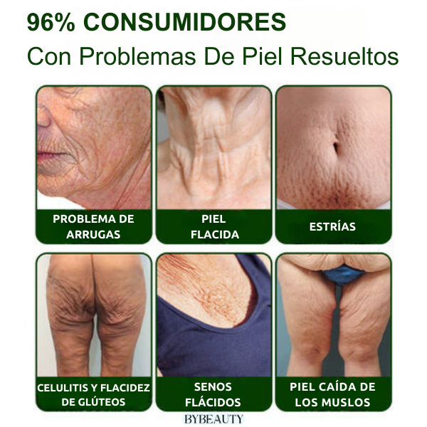 1+1 GRATIS - AVOCURA™ | LA CREMA VIRAL A BASE DE AGUACATE QUE REAFIRMA Y REJUVENECE TU PIEL