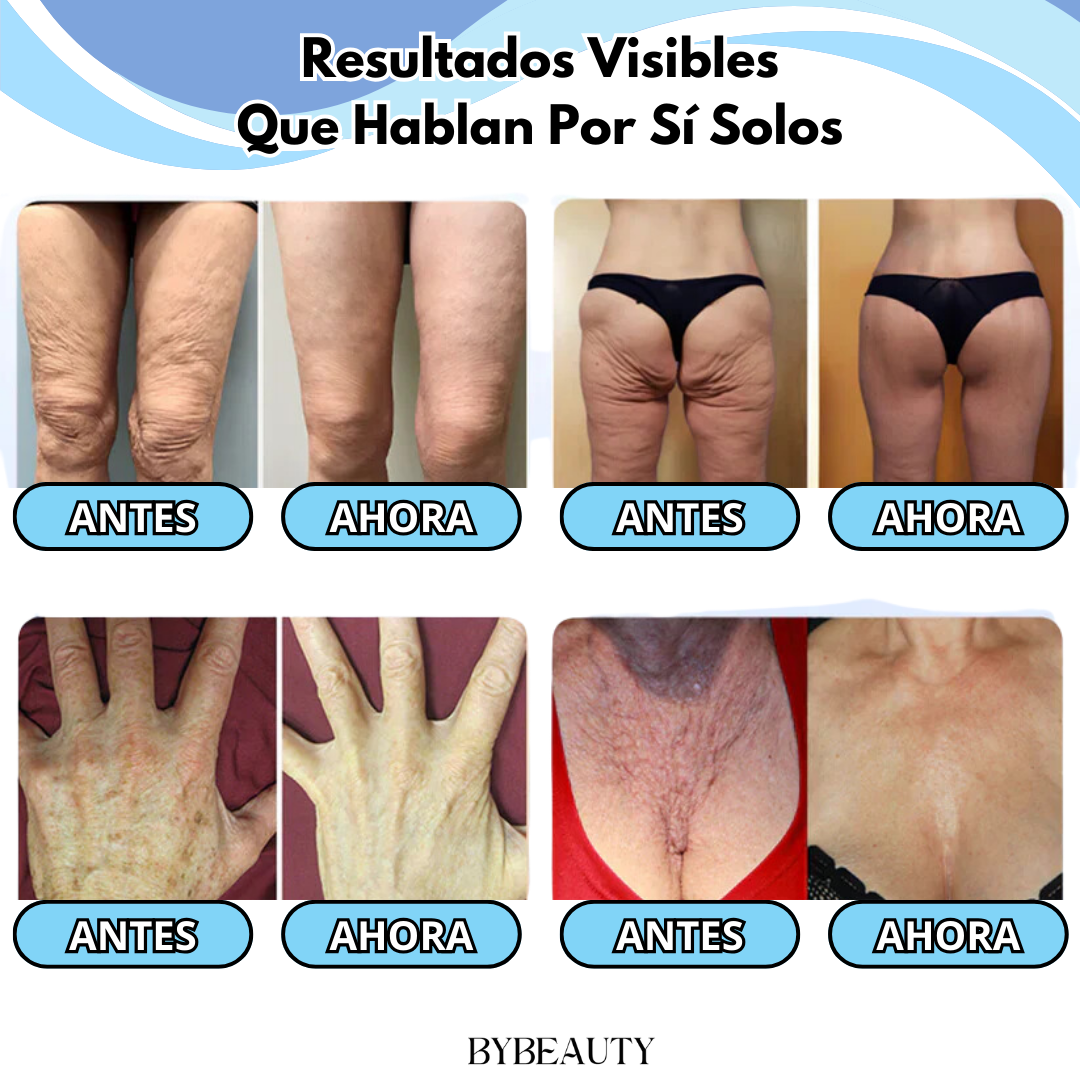 1+1 GRATIS BODYLIFT™ | DILE ADIOS A LA FLACIDEZ Y OBTÉN LA PIEL QUE SIEMPRE HAS SOÑADO