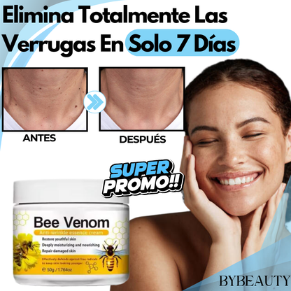 1+1 GRATIS CREMA BEE VENOM | LA PRIMERA CREMA PARA VERRUGAS CON INGREDIENTES 100% NATURALES