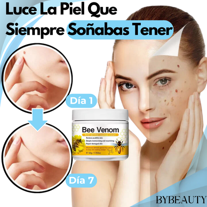 1+1 GRATIS CREMA BEE VENOM | LA PRIMERA CREMA PARA VERRUGAS CON INGREDIENTES 100% NATURALES