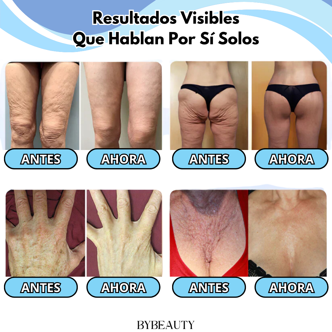 1+1 GRATIS FIRMFLEX™ | RECUPERA LA FIRMEZA DE TU PIEL SIN QUIRÓFANO