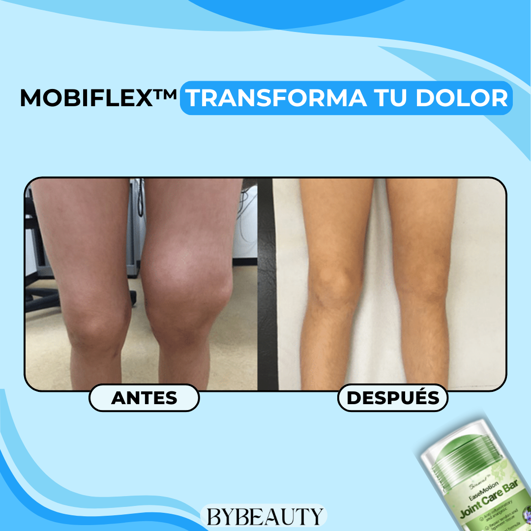 1+1 GRATIS - MOBIFLEX™ | LA SOLUCION NATURAL PARA LOS PROBLEMAS ARTICULARES