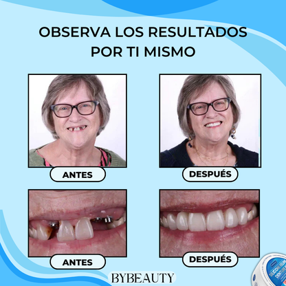 1+1 GRATIS - PERFECTDENT™ | LA SOLUCION INSTANTÁNEA PARA UNA SONRISA PERFECTA