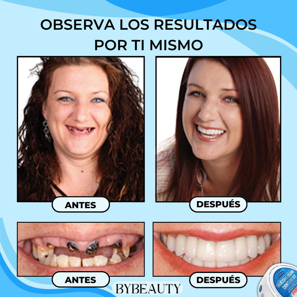 1+1 GRATIS - PERFECTDENT™ | LA SOLUCION INSTANTÁNEA PARA UNA SONRISA PERFECTA