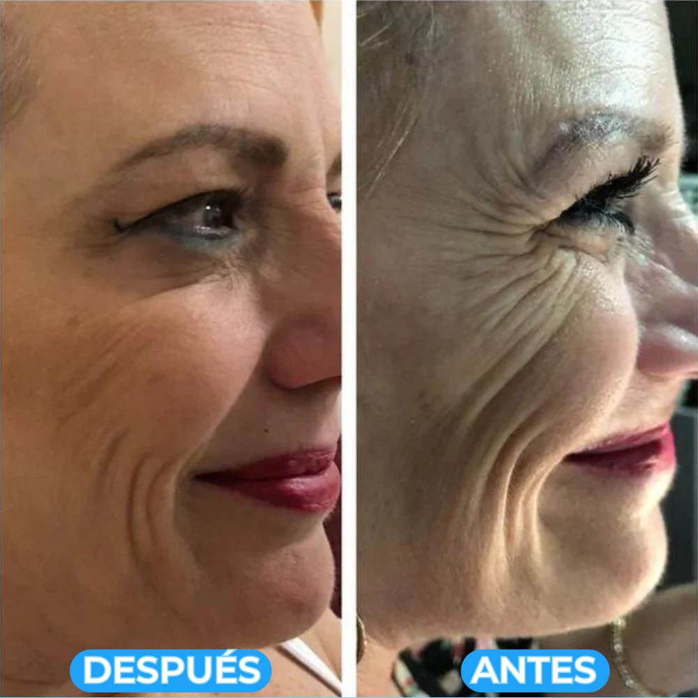 1+1 GRATIS - RETIFIRM™ | LA CREMA VIRAL CON INGREDIENTES 100% NATURALES QUE REAFIRMA Y REJUVENECE TU PIEL