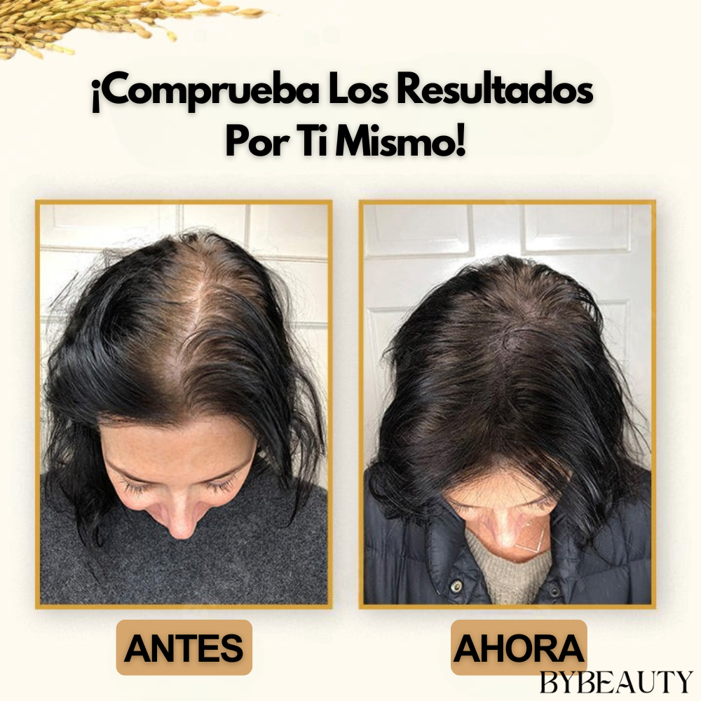 1+1 GRATIS HAIRZEN™ | REDESCUBRE LA BELLEZA NATURAL DE TU PELO