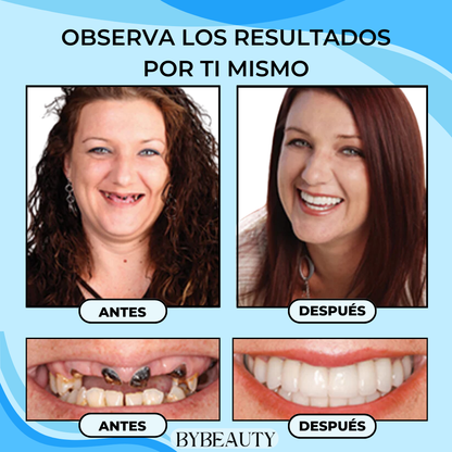 1+1 GRATIS - SMILEFLEX™ | RECUPERA TU DENTADURA Y ELIMINA TUS INSEGURIDADES